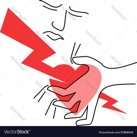 Heart Attack Myocardial Cardiac Infarction Vector Image