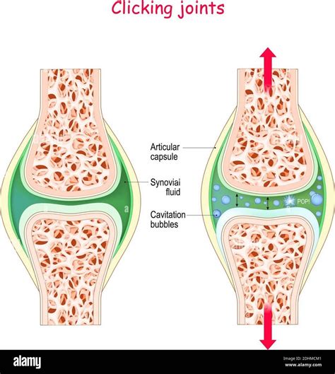 Crepitus — Touchline Physio