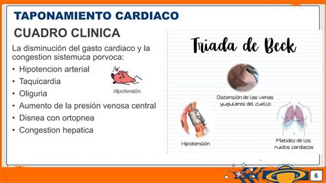 Taponamiento Cardiaco Shelby PPT