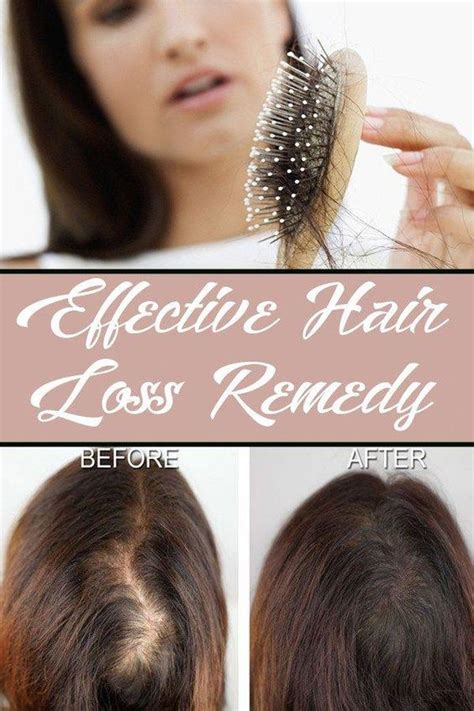 Finding Hair Loss Prevention Methods That Works - wellness topic