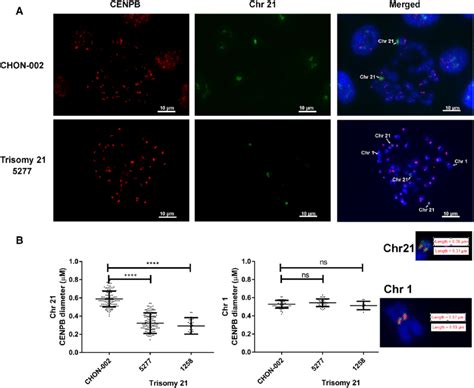 Reduced Cenpb Binding To The Centromere Of Chr In Trisomy Cells