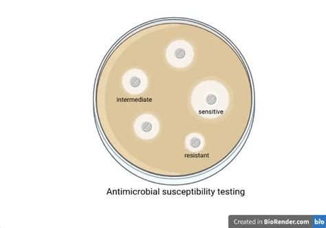 What does Susceptible, Intermediate, and Resistant Mean? • Microbe Online