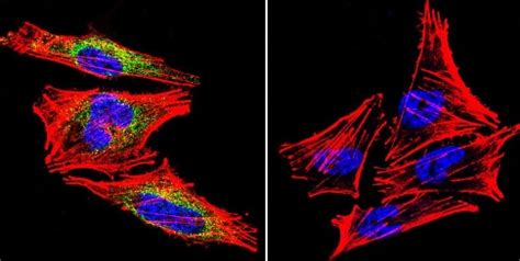 Anti Prolactin Receptor PRL R Antibody U5 Ab2772 Abcam