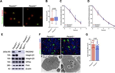 PACSIN2 regulates platelet integrin β1 hemostatic function Journal of