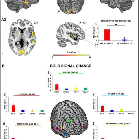 Brain activations resulting from listening to Interjections Vocal... | Download Scientific Diagram