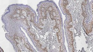 Milieu R Actionnel Alk Leica Biosystems Pour Immunohistochimie