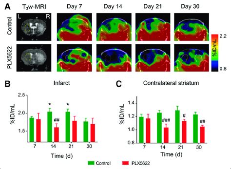 A Representative F Dpa Tspo Pet Ct Images And Corresponding