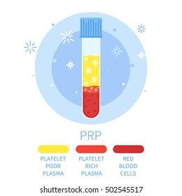 Test Tube Filled Blood Prp Procedure Stock Illustration