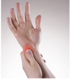 Ulnar Side Wrist Pain Specialists On Hand