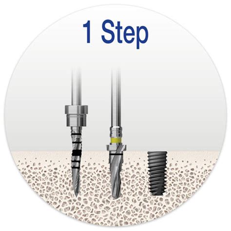 Osstem Implant