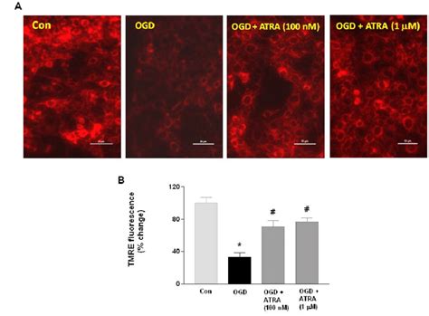 Oxygen Glucose Deprivation OGD Induced Depolarization Of The