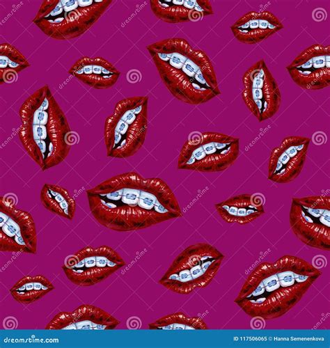 Red Lips Braces Illustration Erotic Playful Hot Clipart Modern Smile Fashion Illustration Pop