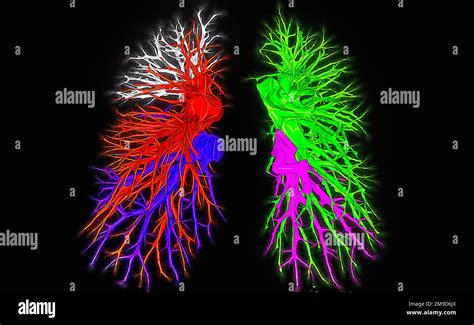 Healthy lungs, CT scan Stock Photo - Alamy