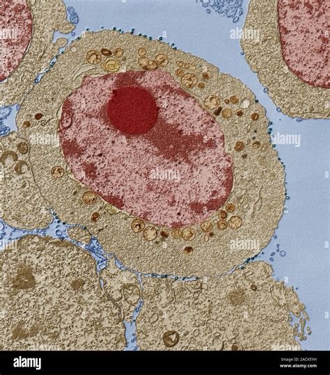 Apoptosis Of HIV Infected Cell Coloured Transmission Electron