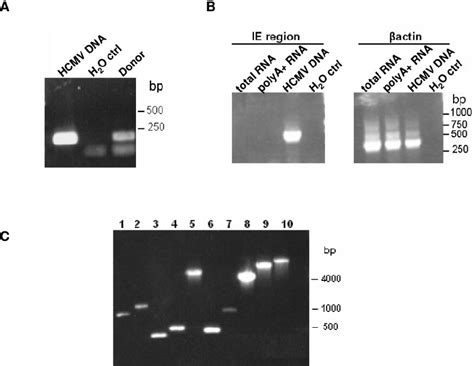 CDNA Library Construction From Monocyte MRNA A Presence Of HCMV DNA