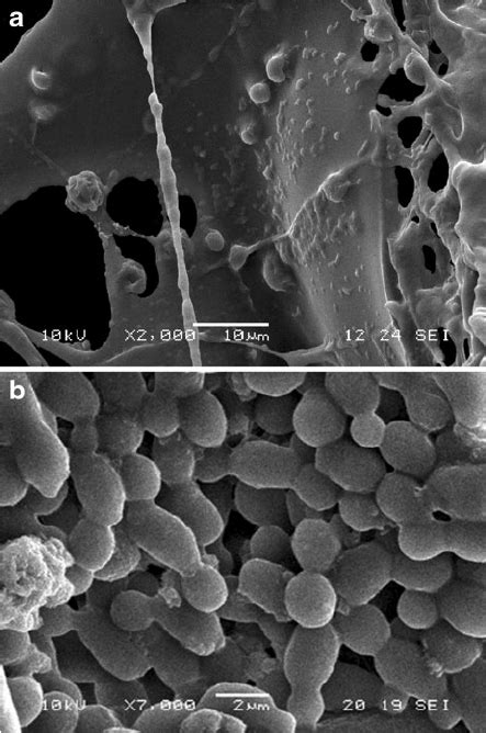 Scanning Electron Micro Graph Of The Hec Cryogel With Immobilized S