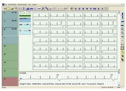 CONTEC TLC5000 Holtery EKG Rejestratory Medipment Pl