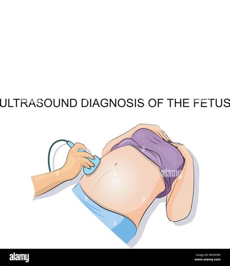 Ilustración Del Proceso Del Ultrasonido Diagnóstico De Embarazadas