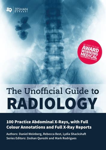 Unofficial Guide To Radiology 100 Practice Abdominal X Rays EBook By