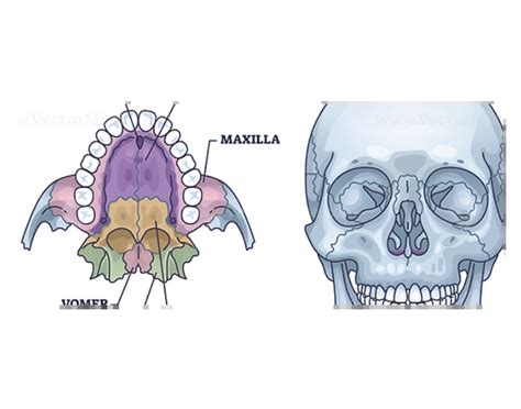 maxillae bone anatomy Quiz