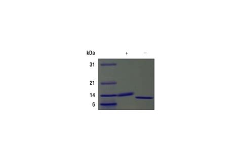 Mouse Gm Csf Recombinant Protein Cell Signaling Technology