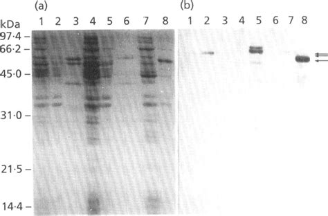 Localization Of Heterologously Expressed Clostripain In E Coli Crude