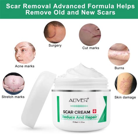 Aliver Scar Cream Reduce And Repair Worldwide Shipping Retail Wholesale