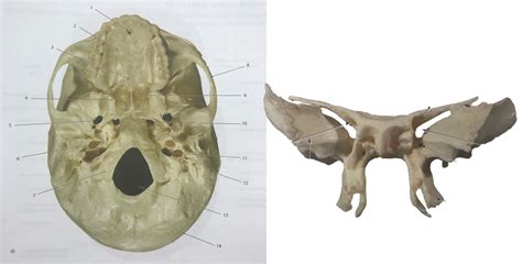 Sphenoid Bone The Skull Inferior View Diagram Quizlet