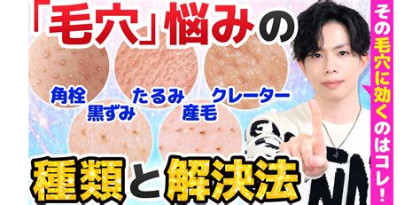 【あなたの毛穴悩みはどのタイプ？】毛穴悩みの種類と解決法！効くスキンケア＆美容医療を解説 かずのすけの化粧品評論と美容化学についてのぼやき