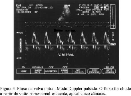 Scielo Brasil Ecocardiografia Modo Doppler Pulsado Em Gatos