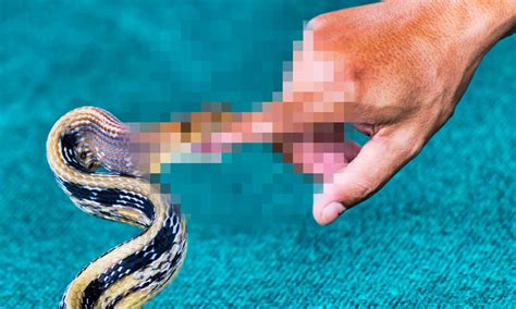 How The World S Worst Snakebite Became A Viral Hit For A 200 Year Old