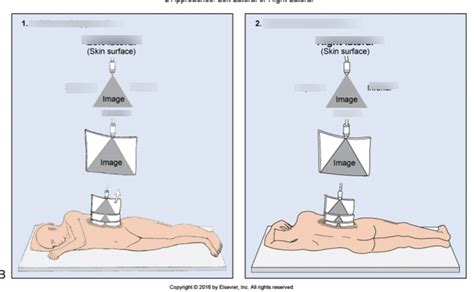 Coronal Plane Diagram Quizlet