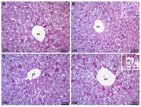 Hematoxylin Eosin Staining A Liver Of Control Rats As Expected The