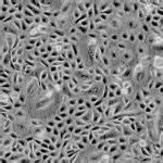 Human Ovarian Surface Epithelial Cells Innoprot Ovary Cell System