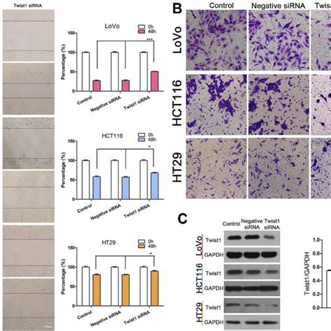 TWIST1 Knockdown Reduced CRC Cell Invasive And Migration Capability