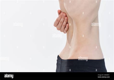 Anorexic Ribs Hi Res Stock Photography And Images Alamy