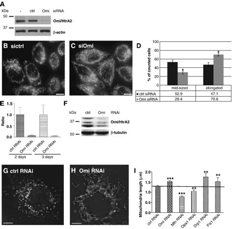 Mitochondrial Morphology In Omi HtrA2 Silenced HeLa And S2R Cells A