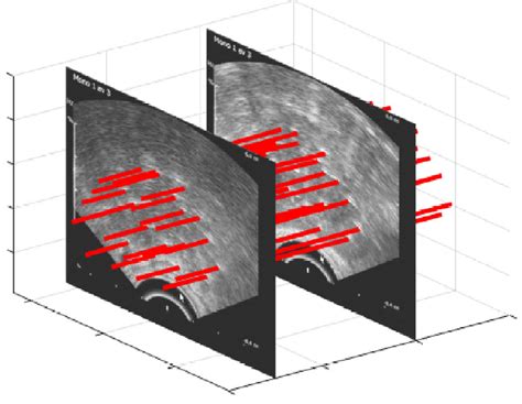 Ultrasound Images Encompassing The Complete Prostate Gland With Download Scientific Diagram