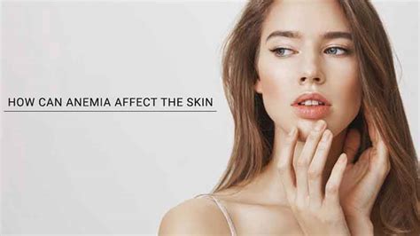 How can anemia affect the skin? – SavarnasMantra