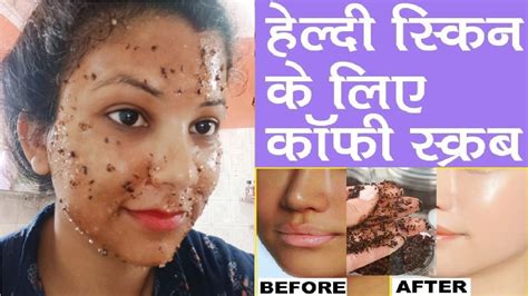 Skin Whitening Coffee Face Scrub Get Glowing Spotless Skin Coconut