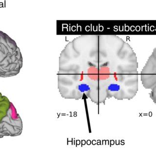 Areas Comprising The Rich Club In The Human Brain A Total Of 6