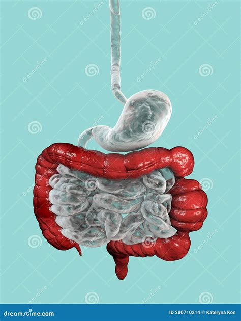 A 3d Illustration Depicting The Large Bowel With Highlighted Spasms