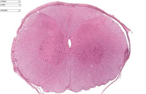 Spinal Cord Cross Section Histology Labeled