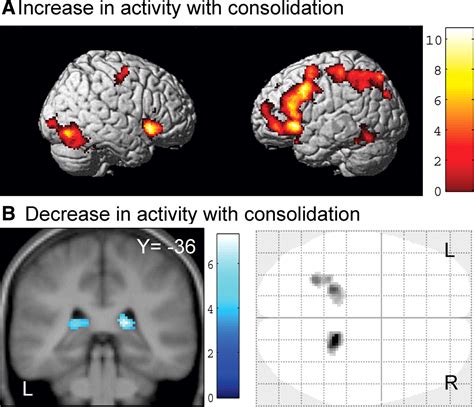 Shift From Hippocampal To Neocortical Centered Retrieval Network With