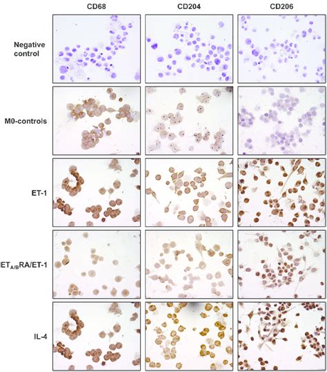 Evaluation Of CD68 CD204 And CD206 Expression In Cultured