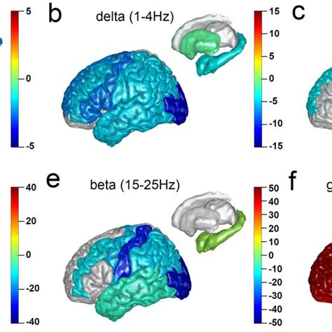 Structural Mapping For Intracranial Eeg Power Changes After Ketamine