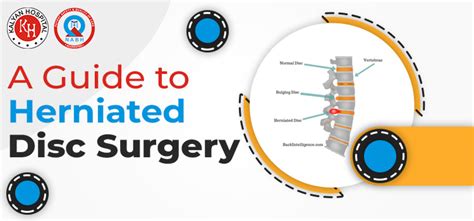 Post-Surgery Tips for Herniated Disc Patients