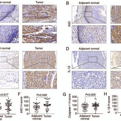 Expression Levels Of A Nlrp B Asc C Caspase And D Il