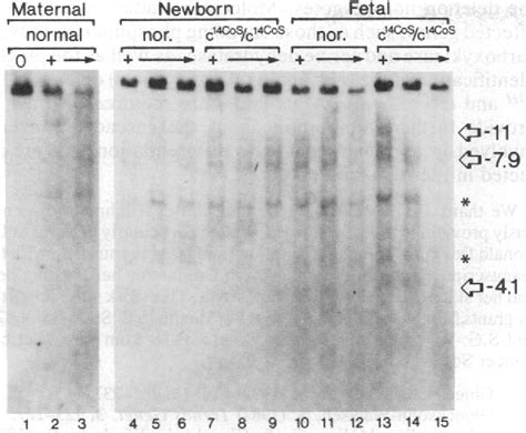 Figure From Selective Loss Of A Dnase I Hypersensitive Site Upstream