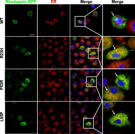 Co Localization Of Rhodopsin With The ER Marker Immunofluorescent